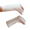 Rolyan Pre-Formed Burn Splint